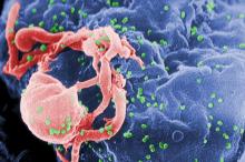 microscopic image of HIV