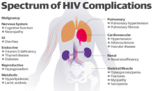 Image noting the spectrum of HIV Complications